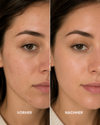 AHA Peeling Concentrate